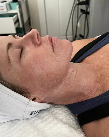 Understanding Hyperpigmentation: Causes, Treatments, and Prevention