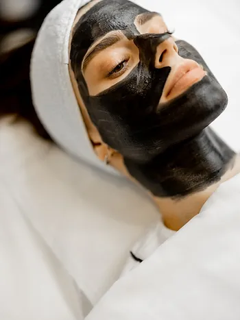 The Benefits of Carbon Laser Peel for Acne-Prone Skin