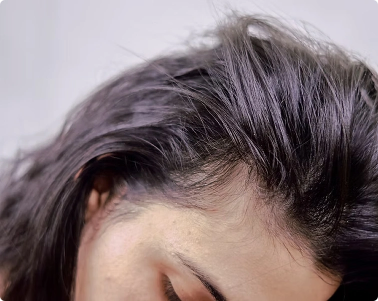 Breakthrough Treatment