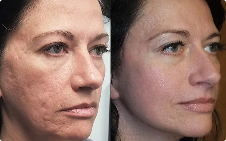 What Can Lasers Treat