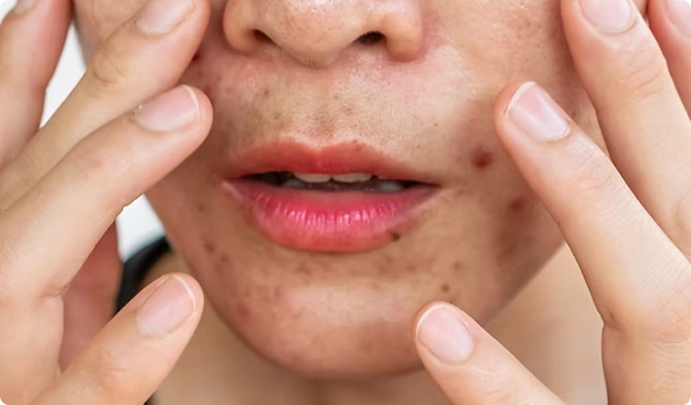 Why Choose MD Laser Clinic